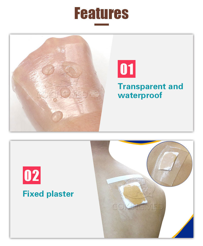 Cokingmed Non-Sterile Adhesive Tape (PU Dressing Roll)