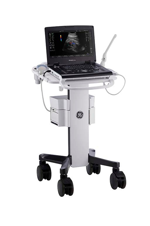 GE Versana Active Portable Color Doppler Ultrasound