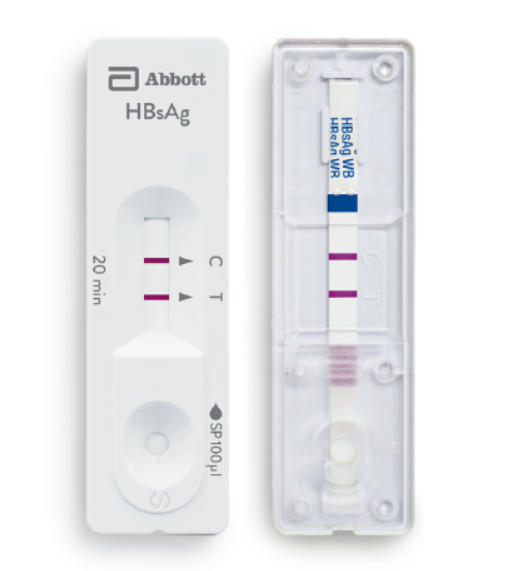 Bioline HBsAg Device (S/P)