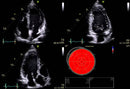 GE Vivid T9 Cardiovascular Ultrasound